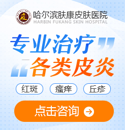 哈尔滨皮炎专科医院:皮炎和皮癣的区别
